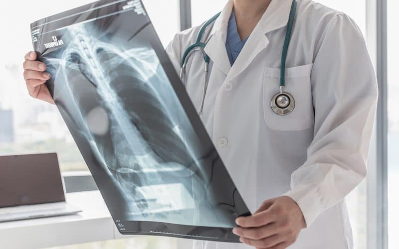 doctor looking at chest x-ray for respiratory conditions