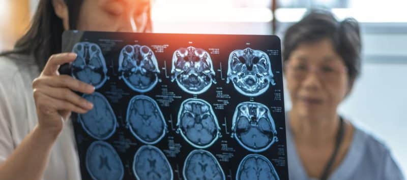 A Doctor Showing Mri Scans To A Patient After Their Brain Was Scanned Regarding Cognitive Decline. 