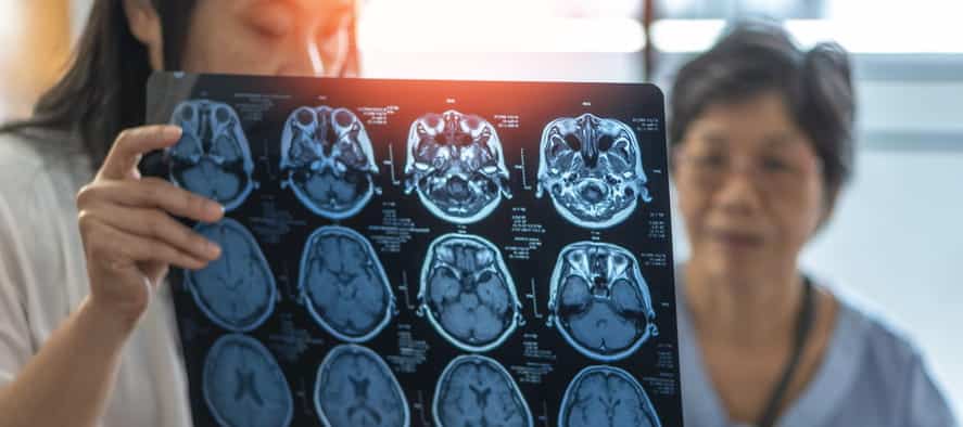 A Doctor Showing Mri Scans To A Patient After Their Brain Was Scanned Regarding Cognitive Decline.