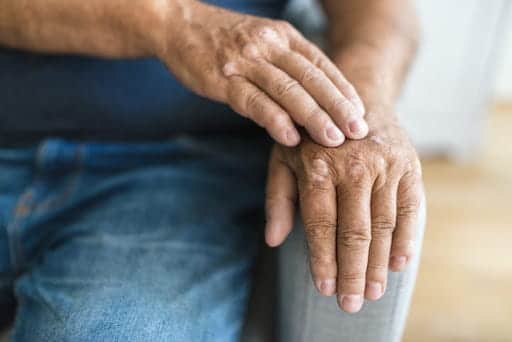 A man with Arthritis rubbing his hands