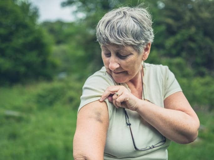 An elderly woman pulling up her sleeve to show a bruise on her arm. 