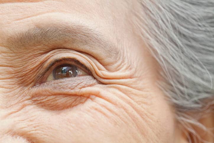 A closeup of the skin around an elderly person's eye.