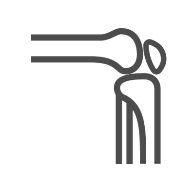 An illustrated knee joint