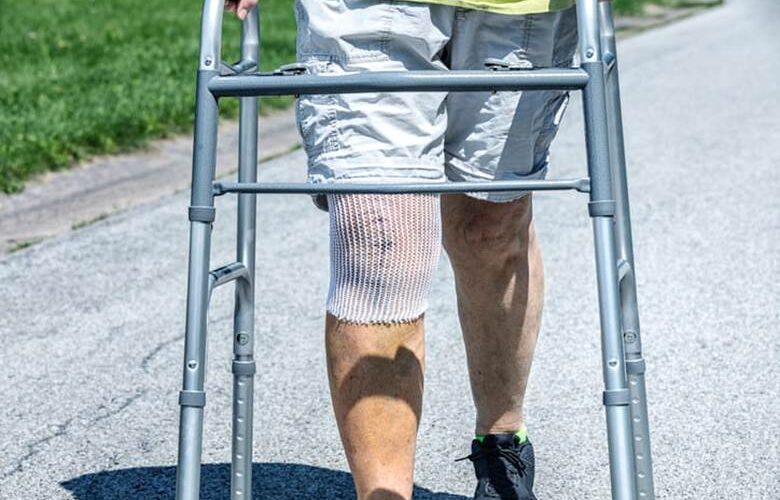 A Person Recovering From Knee Surgery Walks With A Walker.