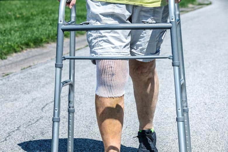 A Person Recovering From Knee Surgery Walks With A Walker. 